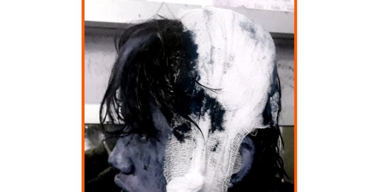 धरानमा साथी र आमा सङ्गै हिंडेपछी खुकुरी प्रहार